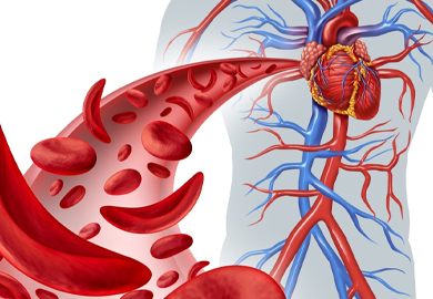 KALP TÜMÖRLERİ – MİKSOMALAR 
