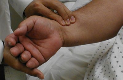 Üst Ekstremite Arter Hastalıkları Üst Ekstremite Arter Hastalıkları